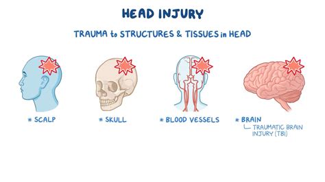What are Head.